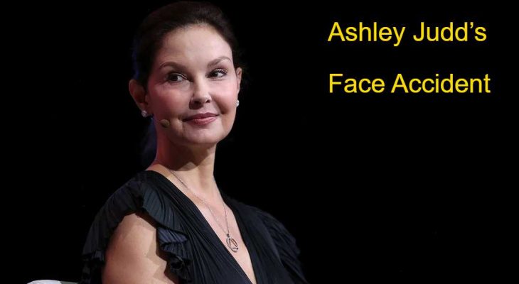 ashley judd face accident