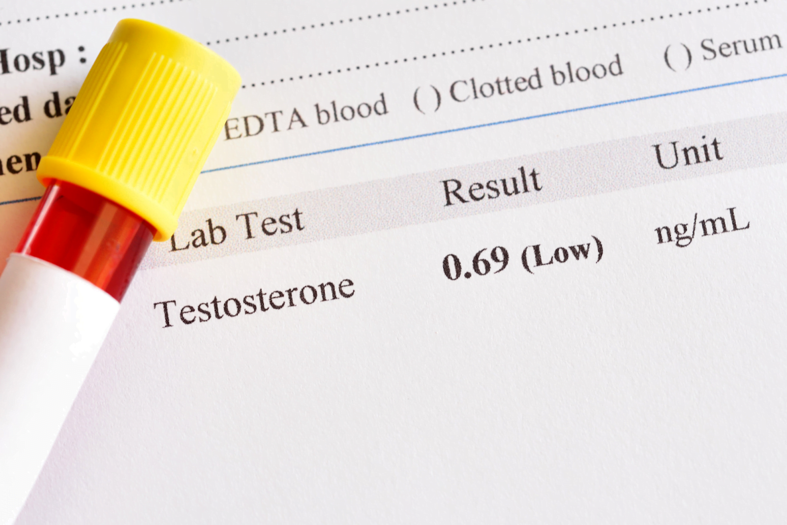 Testosterone Replacement Therapy Benefits