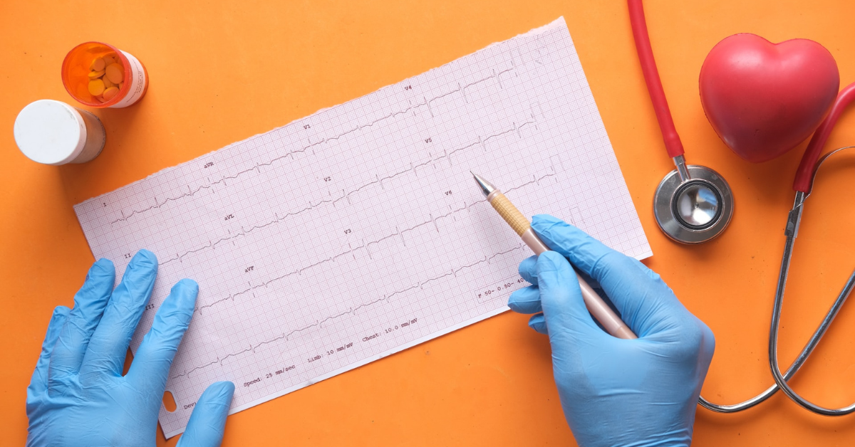 Role of ECG-EEG Tests in Diagnosing Brain Disorders