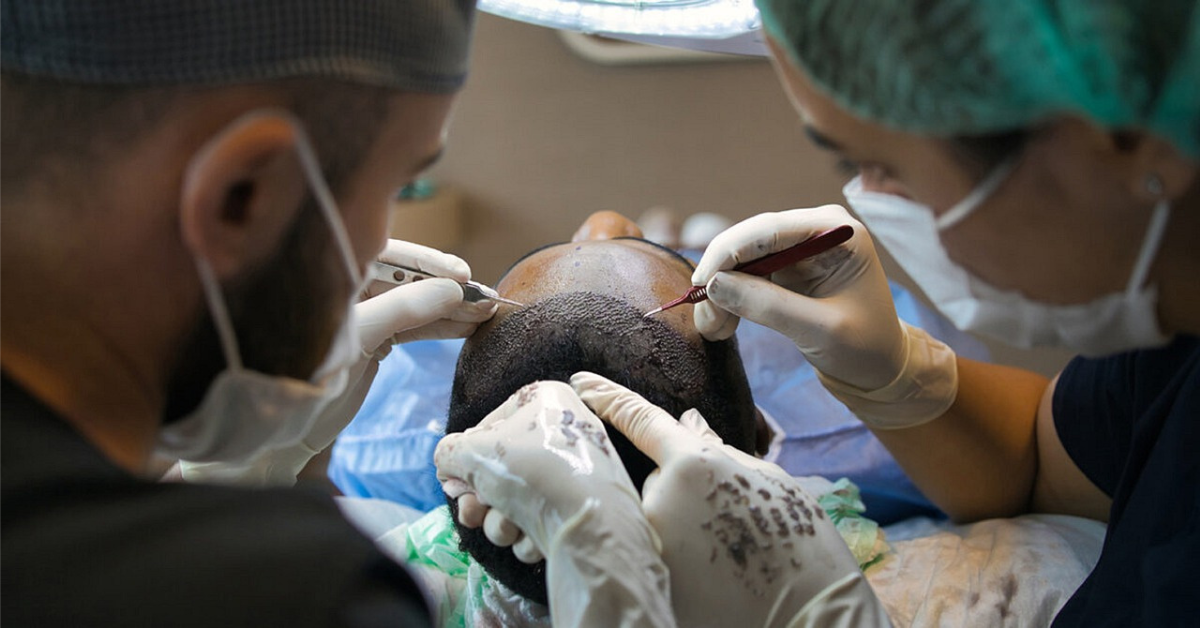 DHI Hair Transplant in Turkey